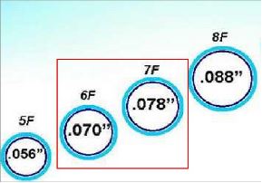 guide catheter